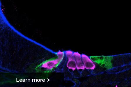 Enhanced microscopic image showing sensory hair cells (colored pink) developing in a newborn mouse cochlea.